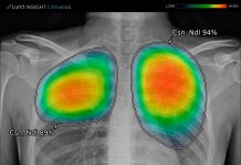 radiografías torácicas