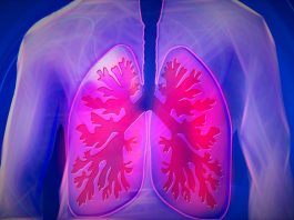 Neumonía causada por Covid-19 puede dejar importantes secuelas respiratorias | Portal Red Salud