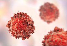 María de los Ángeles Rodríguez, presidenta de la Sociedad Chilena de Hematología: “Necesitamos visibilizar los avances de tratamientos en leucemia”