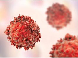 María de los Ángeles Rodríguez, presidenta de la Sociedad Chilena de Hematología: “Necesitamos visibilizar los avances de tratamientos en leucemia”