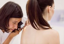 En Chile se diagnostican más de 800 casos de melanoma al año