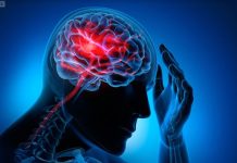 Uno de cuatro personas en Chile sufrirá un Ataque Cerebro Vascular a lo largo de su vida