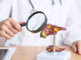 El ABC de la hepatitis: todo lo que debes saber