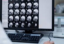Especialista UCSC explica cómo afecta el Síndrome de la Persona Rígida