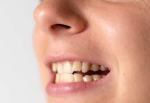 Ortodoncia lingual, la solución definitiva para problemas dentales complejos