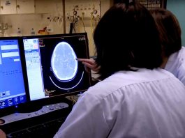 Día Mundial del Accidente Cerebrovascular: el método para identificar síntomas de un ACV de forma temprana 
