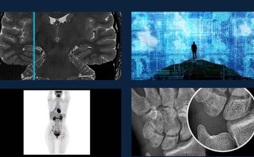 Evolución de la radiología: Innovación y seguridad en el cuidado de la salud