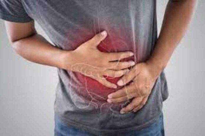 Gastroenterólogos alertan: Enfermedades inflamatorias intestinales requieren urgente actualización de tratamientos