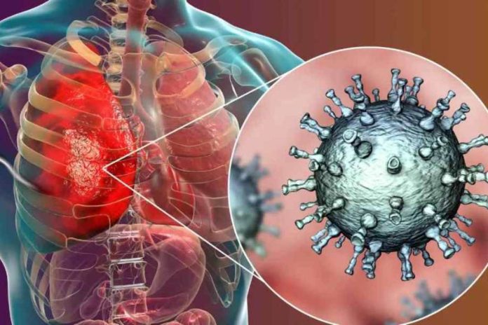 Metapneumovirus ¿de qué se trata el nuevo virus que alerta a China