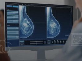Inteligencia Artificial: una herramienta clave para la detección temprana del cáncer de mama en Chile