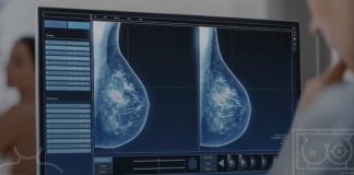 Inteligencia Artificial: una herramienta clave para la detección temprana del cáncer de mama en Chile