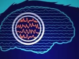 Estudio: La estimulación cerebral profunda personalizada podría tratar la epilepsia resistente a los fármacos