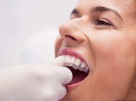 Bruxismo: Una causa de la pérdida de piezas dentales