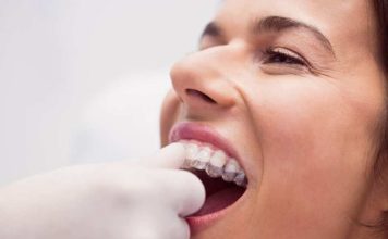 Bruxismo: Una causa de la pérdida de piezas dentales