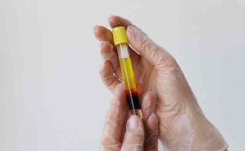 Suero Rico en Factores más Ácido Hialurónico (SRF+): La innovación tecnológica en salud que se abre paso en Chile