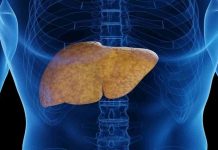 ¡Cuidado con el Hígado Graso! Puede poner en riesgo tu salud