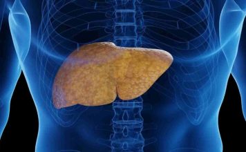 ¡Cuidado con el Hígado Graso! Puede poner en riesgo tu salud