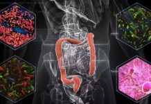 A menudo visto como desecho, las heces pueden proporcionar pistas sobre el papel de la microbiota en el tratamiento del cáncer