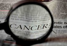 Diagnóstico de Cáncer de Próstata en el Ex Presidente Biden reabre debate sobre limitaciones del PSA y destaca la braquiterapia como tratamiento.
