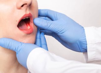 Detectar a tiempo puede salvar vidas: Expertos alertan sobre el cáncer mandibular y sus síntomas más comunes