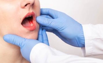 Detectar a tiempo puede salvar vidas: Expertos alertan sobre el cáncer mandibular y sus síntomas más comunes