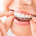 Gracias a la IA tratamientos de brackets invisibles bajan costos y tiempos
