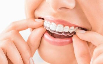 Gracias a la IA tratamientos de brackets invisibles bajan costos y tiempos