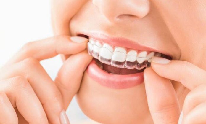 Gracias a la IA tratamientos de brackets invisibles bajan costos y tiempos