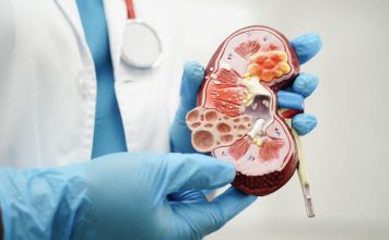 Cáncer de riñón: Advierten incremento de casos por envejecimiento poblacional