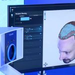 El futuro del tratamiento capilar ya está en Chile, combinando Inteligencia Artificial e innovación para resultados precisos