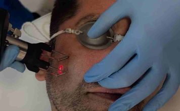 El láser que rejuvenece sin dejar huella ya se aplica en Chile