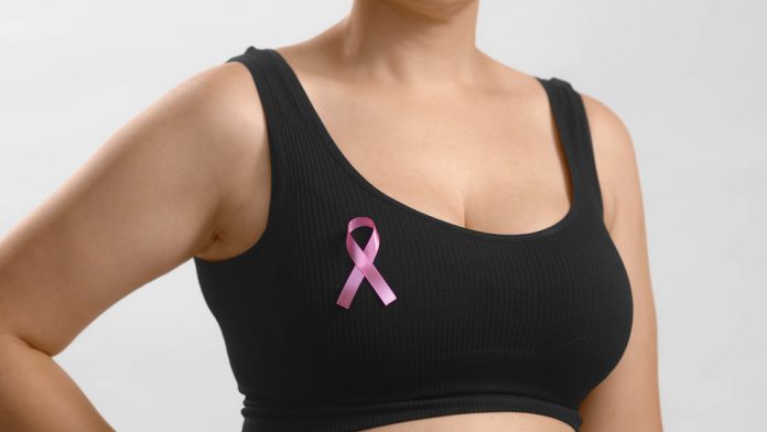 Llega a Chile inteligencia artificial como apoyo en la lucha contra el cáncer de mama