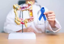 Preocupante alza de cáncer colorrectal en menores de 50 años en Chile: estudio de oncólogo UDD fue presentado en congreso mundial