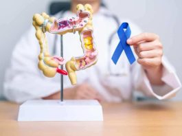 Preocupante alza de cáncer colorrectal en menores de 50 años en Chile: estudio de oncólogo UDD fue presentado en congreso mundial