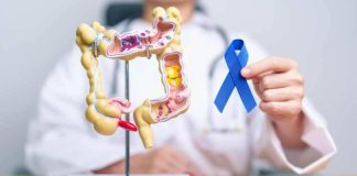 Preocupante alza de cáncer colorrectal en menores de 50 años en Chile: estudio de oncólogo UDD fue presentado en congreso mundial