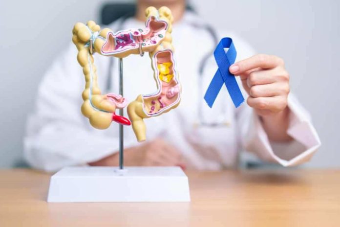 Preocupante alza de cáncer colorrectal en menores de 50 años en Chile: estudio de oncólogo UDD fue presentado en congreso mundial