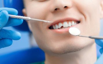 ¿Te golpeaste en los dientes? Esto es lo que debes hacer según una odontóloga