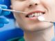 ¿Te golpeaste en los dientes? Esto es lo que debes hacer según una odontóloga