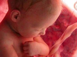 Julio: Mes de la concientización sobre la sangre del cordón umbilical 