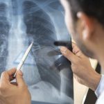 Mayo Clinic en Arizona anuncia el lanzamiento de un nuevo programa de trasplante de pulmón