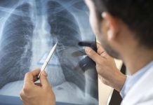 Mayo Clinic en Arizona anuncia el lanzamiento de un nuevo programa de trasplante de pulmón
