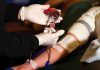 Operarse con tu propia sangre la alternativa médica que podría revolucionar las cirugías en Chile