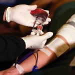 Operarse con tu propia sangre la alternativa médica que podría revolucionar las cirugías en Chile