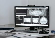 ¿Cómo funciona una radiografía? ¿Son peligrosas para la salud?