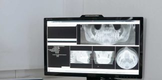 ¿Cómo funciona una radiografía? ¿Son peligrosas para la salud?