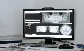 ¿Cómo funciona una radiografía? ¿Son peligrosas para la salud?