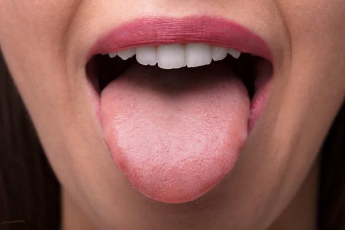 ¿Sabes realmente cómo limpiar tu lengua Especialista entrega indicaciones para una correcta higiene