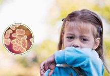 Alerta por coqueluche ¿Qué es, a quiénes afecta y cómo prevenir esta enfermedad que puede ser mortal