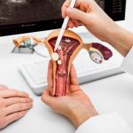 Cáncer cervicouterino expertos convocan a periodistas para fortalecer la cobertura en salud pública