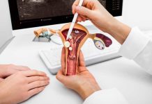 Cáncer cervicouterino expertos convocan a periodistas para fortalecer la cobertura en salud pública
